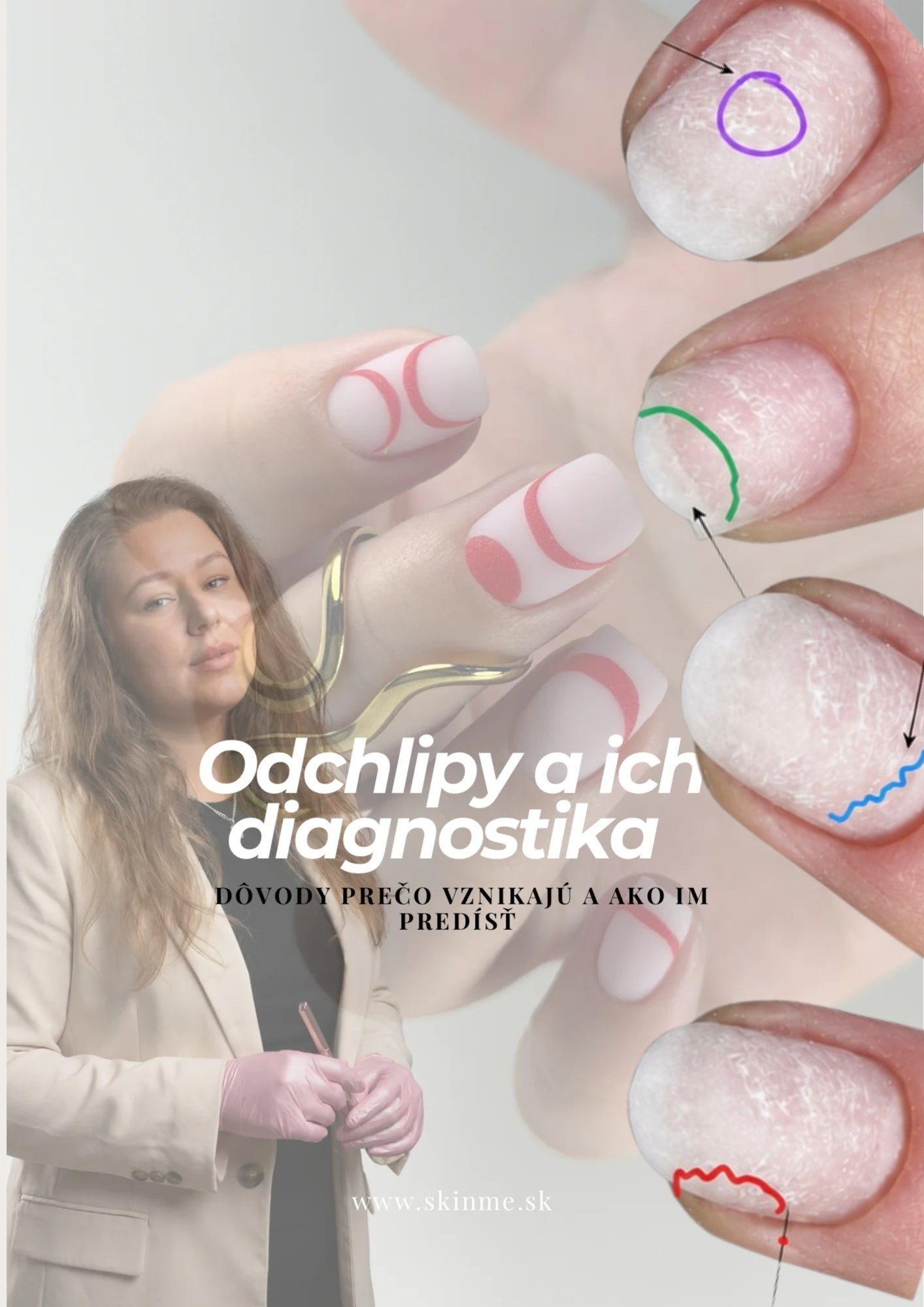 💅 Odchlipy - prečo sa tvoria a ako ich diagnostikovať